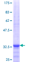 ab164791 on a 12.5% SDS-PAGE stained with Coomassie Blue.