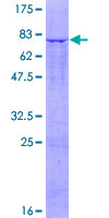 ab165033 on a 12.5% SDS-PAGE stained with Coomassie Blue.