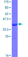ab165034 on a 12.5% SDS-PAGE stained with Coomassie Blue.