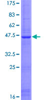 ab164381 on a 12.5% SDS-PAGE stained with Coomassie Blue.