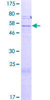 ab164391 on a 12.5% SDS-PAGE stained with Coomassie Blue.