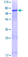 ab164844 on a 12.5% SDS-PAGE stained with Coomassie Blue.