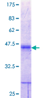 ab158322 on a 12.5% SDS-PAGE stained with Coomassie Blue.