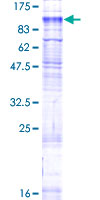 ab163916 on a 12.5% SDS-PAGE stained with Coomassie Blue.