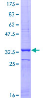 ab163917 on a 12.5% SDS-PAGE stained with Coomassie Blue.