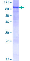ab161232 on a 12.5% SDS-PAGE stained with Coomassie Blue.