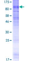 ab160363 on a 12.5% SDS-PAGE stained with Coomassie Blue.