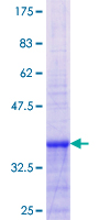 ab160364 on a 12.5% SDS-PAGE stained with Coomassie Blue.