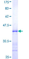 ab163398 on a 12.5% SDS-PAGE stained with Coomassie Blue.