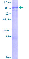 ab161006 on a 12.5% SDS-PAGE stained with Coomassie Blue.