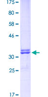 ab160375 on a 12.5% SDS-PAGE stained with Coomassie Blue.