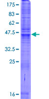 ab161649 on a 12.5% SDS-PAGE stained with Coomassie Blue.