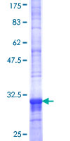 ab161650 on a 12.5% SDS-PAGE stained with Coomassie Blue.