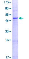 ab165011 on a 12.5% SDS-PAGE stained with Coomassie Blue.