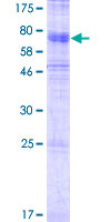 ab164539 on a 12.5% SDS-PAGE stained with Coomassie Blue.