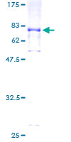ab153368 on a 12.5% SDS-PAGE stained with Coomassie Blue.