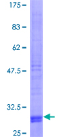 ab153369 on a 12.5% SDS-PAGE stained with Coomassie Blue.