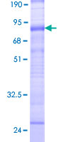 ab161227 on a 12.5% SDS-PAGE stained with Coomassie Blue.