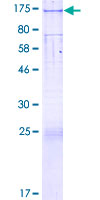 ab163517 on a 12.5% SDS-PAGE stained with Coomassie Blue.