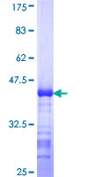 ab163518 on a 12.5% SDS-PAGE stained with Coomassie Blue.