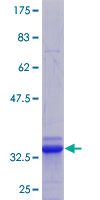 ab164847 on a 12.5% SDS-PAGE stained with Coomassie Blue.