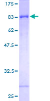 ab166129 on a 12.5% SDS-PAGE stained with Coomassie Blue.