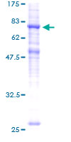 ab159914 on a 12.5% SDS-PAGE stained with Coomassie Blue.
