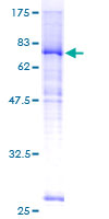 ab159915 on a 12.5% SDS-PAGE stained with Coomassie Blue.