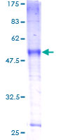 ab163068 on a 12.5% SDS-PAGE stained with Coomassie Blue.