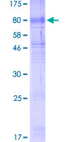 ab153316 on a 12.5% SDS-PAGE stained with Coomassie Blue.