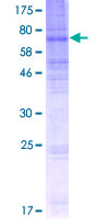 ab162203 on a 12.5% SDS-PAGE stained with Coomassie Blue.