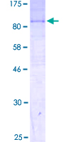 ab163506 on a 12.5% SDS-PAGE stained with Coomassie Blue.