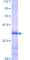 ab163507 on a 12.5% SDS-PAGE stained with Coomassie Blue.