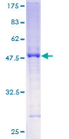 ab162435 on a 12.5% SDS-PAGE stained with Coomassie Blue.
