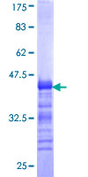 ab160512 on a 12.5% SDS-PAGE stained with Coomassie Blue.