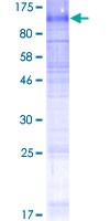 ab159520 on a 12.5% SDS-PAGE stained with Coomassie Blue.