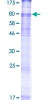 ab159524 on a 12.5% SDS-PAGE stained with Coomassie Blue.