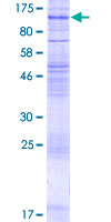 ab163634 on a 12.5% SDS-PAGE stained with Coomassie Blue.