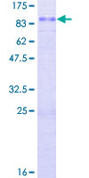 ab159526 on a 12.5% SDS-PAGE stained with Coomassie Blue.