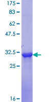 ab159527 on a 12.5% SDS-PAGE stained with Coomassie Blue.