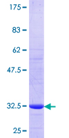 ab160318 on a 12.5% SDS-PAGE stained with Coomassie Blue.