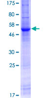 ab159529 on a 12.5% SDS-PAGE stained with Coomassie Blue.