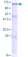 ab161011 on a 12.5% SDS-PAGE stained with Coomassie Blue.