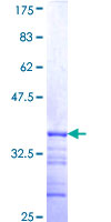 ab161012 on a 12.5% SDS-PAGE stained with Coomassie Blue.