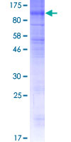 ab166349 on a 12.5% SDS-PAGE stained with Coomassie Blue.