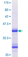 ab153371 on a 12.5% SDS-PAGE stained with Coomassie Blue.