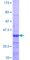 ab153372 on a 12.5% SDS-PAGE stained with Coomassie Blue.