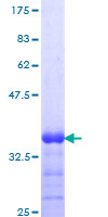 ab152971 on a 12.5% SDS-PAGE stained with Coomassie Blue.