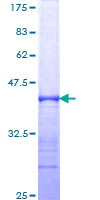 ab153016 on a 12.5% SDS-PAGE stained with Coomassie Blue.