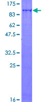 ab161049 on a 12.5% SDS-PAGE stained with Coomassie Blue.